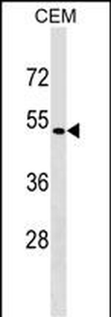SSTR5 Antibody (C-term)