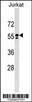 SPAM1 Antibody (C-term)