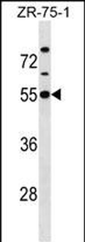 KCNJ1 Antibody (C-term)