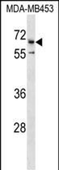 CATSPER2 Antibody (C-term)
