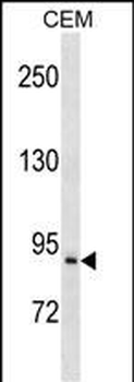 PREP Antibody (Center)