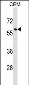 TRIM58 Antibody (C-term)