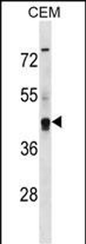 KCNG2 Antibody (Center)