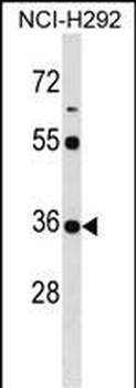 KCTD17 Antibody (Center)