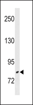 ZBTB17 Antibody (N-term)