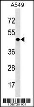 CDY1 Antibody (N-term)