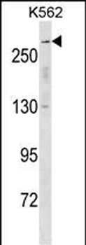 SCN5A Antibody (N-term)
