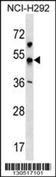 KCNJ18 Antibody (N-term)