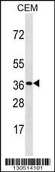 OR3A3 Antibody (C-term)