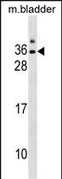 GJE1 Antibody (C-term)