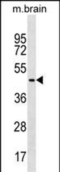 FAF2 Antibody (C-term)