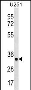 NPL Antibody (N-term)