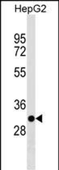 TARM1 Antibody (C-term)