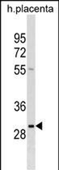 RAB22A Antibody (C-term)
