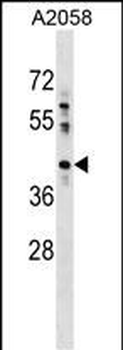 PTPLAD1 Antibody (N-term)