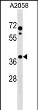 PHLDA1 Antibody (N-term)