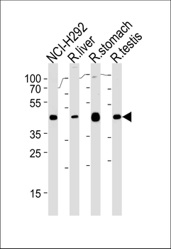PCGF6 Antibody (Center)