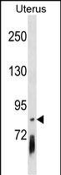 PCDHGB4 Antibody (Center)