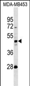 KRT31 Antibody (N-term)