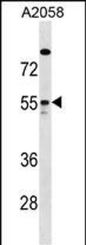 ARHGAP1 Antibody (Center)