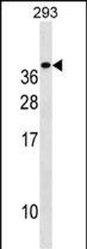 TREM1 Antibody (C-term)