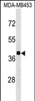 ALDOB Antibody (N-term)