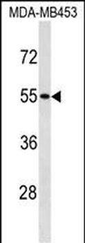 SKAP1 Antibody (C-term)