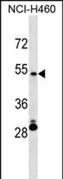 IRX6 Antibody (Center)