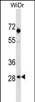 SNX11 Antibody (Center)