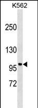 PPP1R9A Antibody (Center)