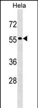 STAU1 Antibody (N-term)