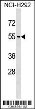NPY1R Antibody (Center)