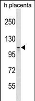 MMS19 Antibody (Center)