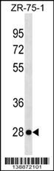KLRF2 Antibody (N-term)