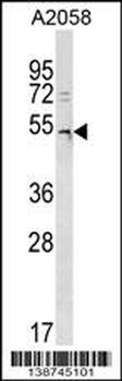 DCAF12L2 Antibody (C-term)