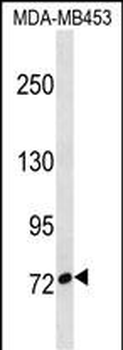 CUX1 Antibody (C-term)