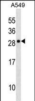 CLCF1 Antibody (N-term)