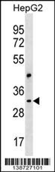 CEP170L Antibody (Center)