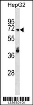 ARHGAP40 Antibody (N-term)