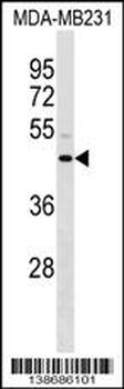 ANXA8L1/ANXA8L2 Antibody (N-term)