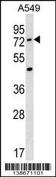 ACSM2A Antibody (N-term)