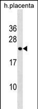 RNF122 Antibody (Center)