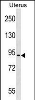 ASTE1 Antibody (N-term)