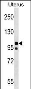 NLRP4 Antibody (N-term)