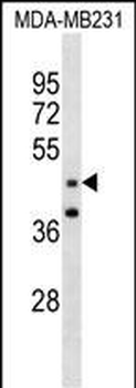 GRAMD3 Antibody (N-term )