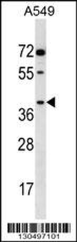 AKR1E2 Antibody (C-term)