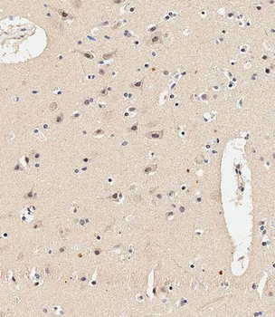 MEK1 Antibody (Center S217/221)