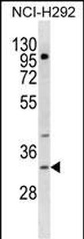 TREML1 Antibody (C-term)