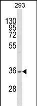 SSBP2 Antibody (N-term)