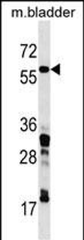 CORO1C Antibody (C-term)
